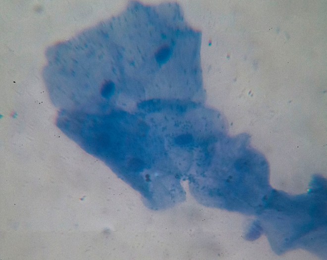 Saliva with methylene blue